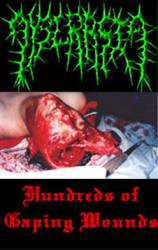 Hundreds of Gaping Wounds